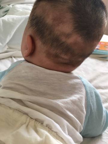 宝宝多久开始补钙（开始补钙宝宝会缺钙吗）-硒宝网