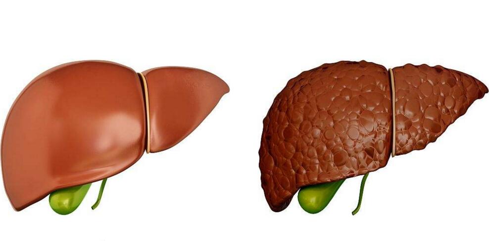 补硒能降低甲胎蛋白吗(甲减补充蛋白质可减轻虚胖么)-硒宝网