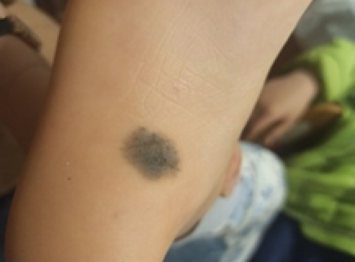 补硒大小便有什么变化（补大小变化硒有效果吗）-硒宝网