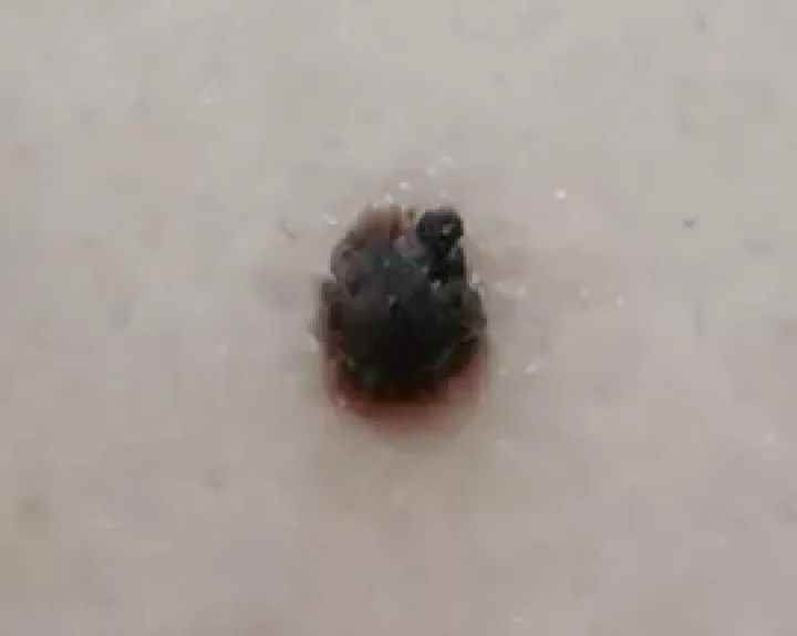 补硒大小便有什么变化（补大小变化硒有效果吗）-硒宝网