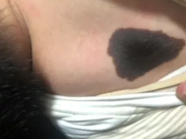 补硒大小便有什么变化（补大小变化硒有效果吗）-硒宝网