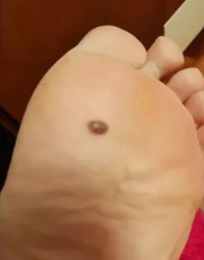 补硒大小便有什么变化（补大小变化硒有效果吗）-硒宝网