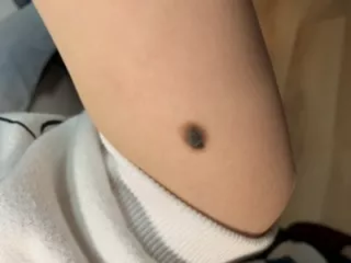 补硒大小便有什么变化（补大小变化硒有效果吗）-硒宝网