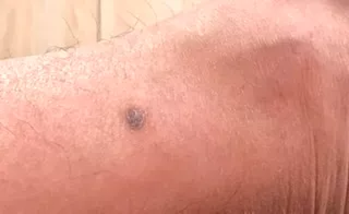 补硒大小便有什么变化（补大小变化硒有效果吗）-硒宝网