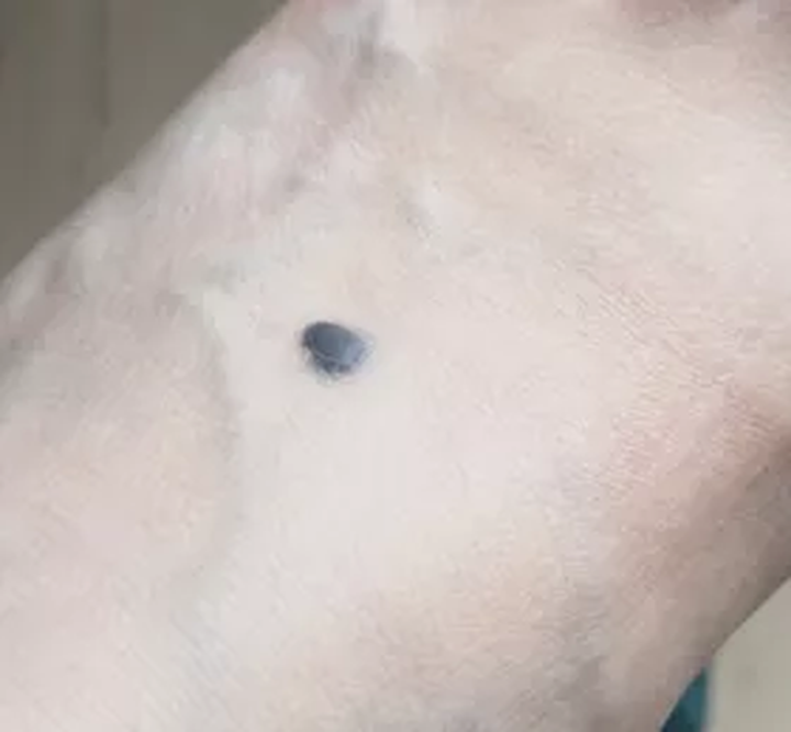 补硒大小便有什么变化（补大小变化硒有效果吗）-硒宝网