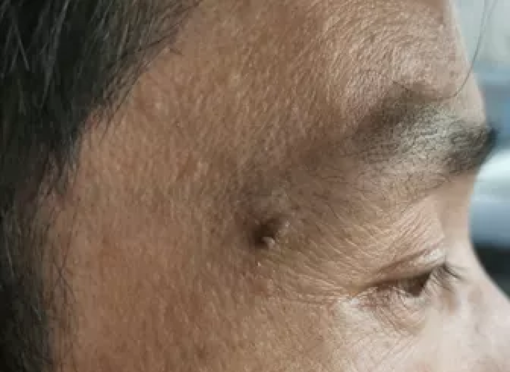 补硒大小便有什么变化（补大小变化硒有效果吗）-硒宝网