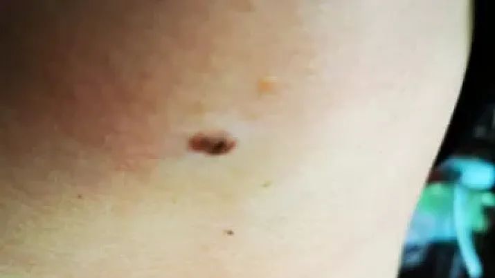 补硒大小便有什么变化（补大小变化硒有效果吗）-硒宝网