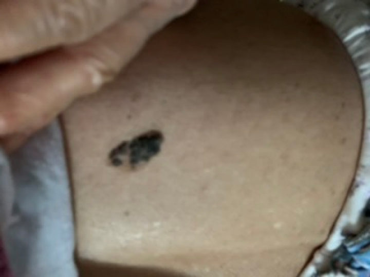 补硒大小便有什么变化（补大小变化硒有效果吗）-硒宝网