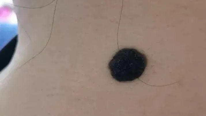 补硒大小便有什么变化（补大小变化硒有效果吗）-硒宝网