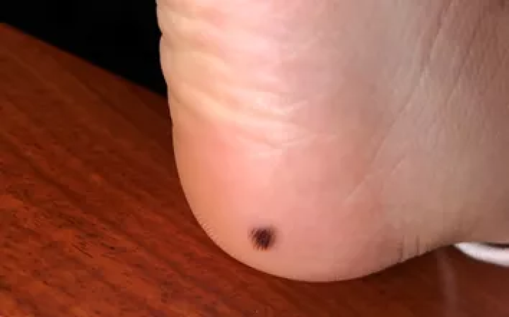 补硒大小便有什么变化（补大小变化硒有效果吗）-硒宝网