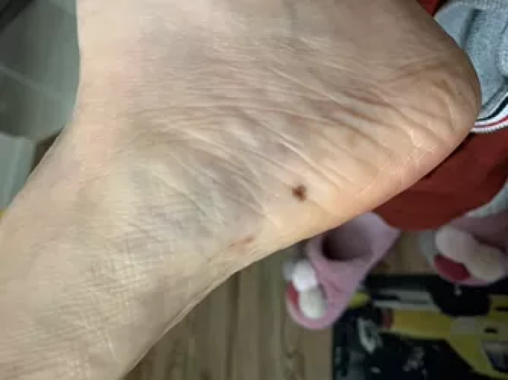 补硒大小便有什么变化（补大小变化硒有效果吗）-硒宝网