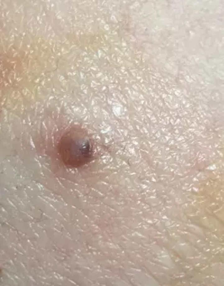 补硒大小便有什么变化（补大小变化硒有效果吗）-硒宝网