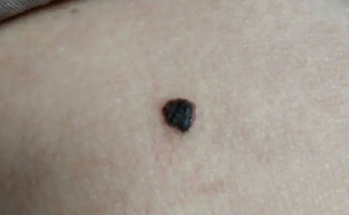 补硒大小便有什么变化（补大小变化硒有效果吗）-硒宝网