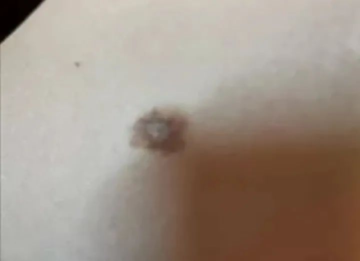 补硒大小便有什么变化（补大小变化硒有效果吗）-硒宝网