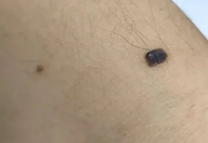 补硒大小便有什么变化（补大小变化硒有效果吗）-硒宝网