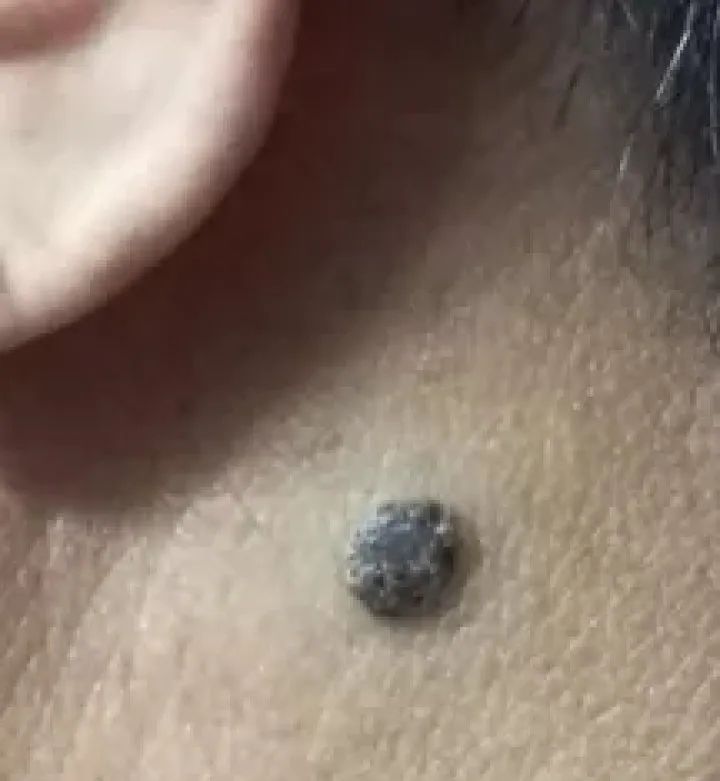 补硒大小便有什么变化（补大小变化硒有效果吗）-硒宝网