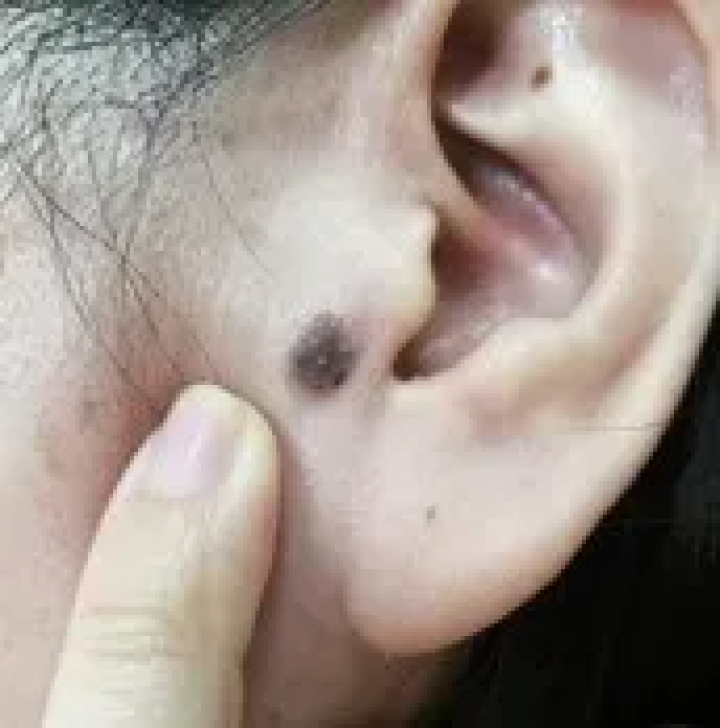 补硒大小便有什么变化（补大小变化硒有效果吗）-硒宝网