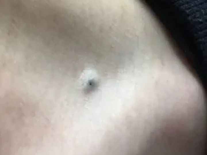 补硒大小便有什么变化（补大小变化硒有效果吗）-硒宝网