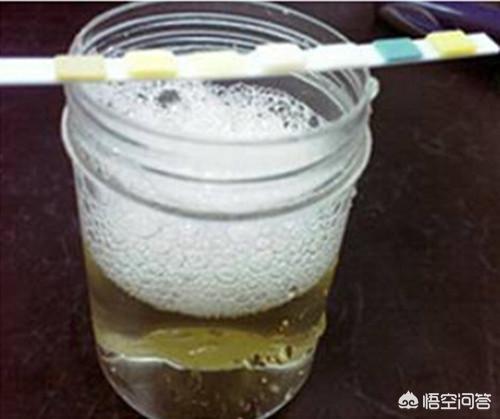 血糖高的人可以补硒吗（硒对血糖高的作用）-硒宝网