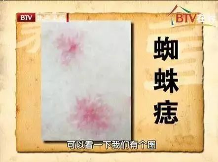 补硒能预防老斑产生吗(补硒预防老年痴呆)-硒宝网