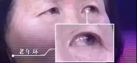 补硒能预防老斑产生吗(补硒预防老年痴呆)-硒宝网