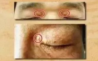 补硒能预防老斑产生吗(补硒预防老年痴呆)-硒宝网