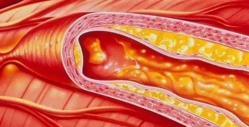 心脑血管疾病能补硒吗(硒心脑血管)-硒宝网