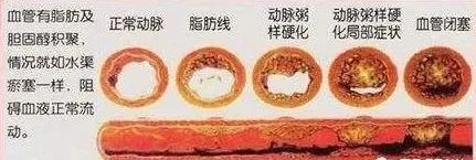 心脑血管疾病能补硒吗(硒心脑血管)-硒宝网
