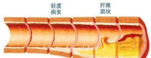 心脑血管疾病能补硒吗(硒心脑血管)-硒宝网