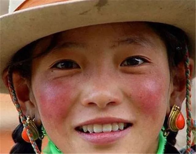 甲亢用不用补硒元素呢（用补元素甲亢硒片会怎样）-硒宝网