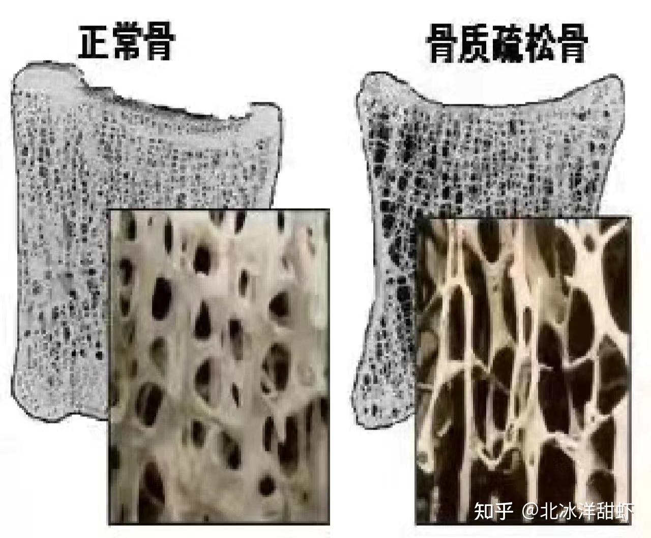 氨糖可以补钙吗(补钙氨糖软骨素好还是钙片好)-硒宝网