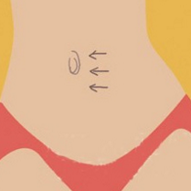 补硒导致耳鸣怎么办呢(补硒导致耳鸣怎么办呢)-硒宝网