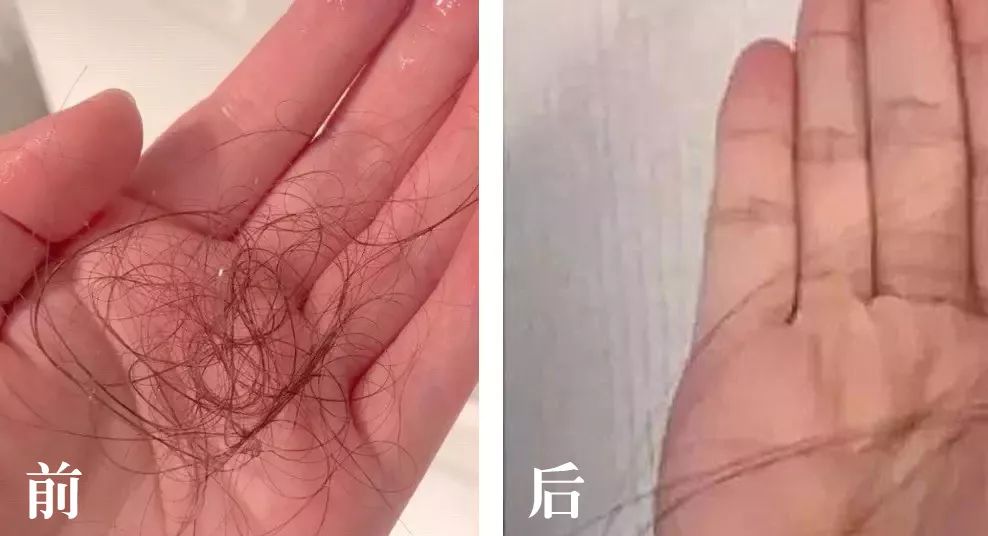 补硒掉发多少天能恢复（补硒脱发是什么原因引起的）-硒宝网