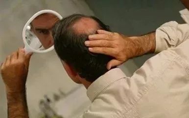 补硒掉发多少天能恢复（补硒脱发是什么原因引起的）-硒宝网