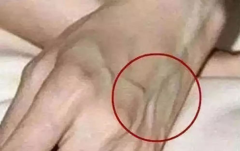 补硒后睡眠好了吗女性(睡眠补女性好硒后会发胖吗)-硒宝网