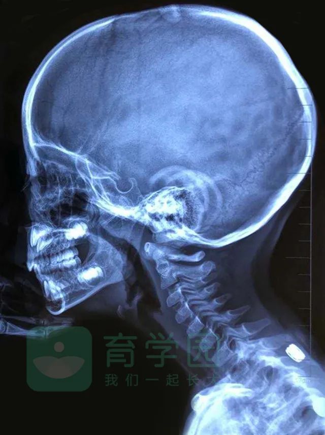 多大开始补钙(小宝宝多大开始补钙)-硒宝网