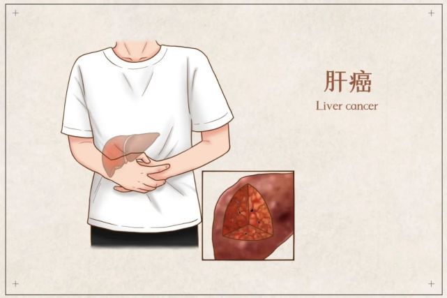 脂肪肝的人可以补硒吗(脂肪肝吃硒有效果吗)-硒宝网