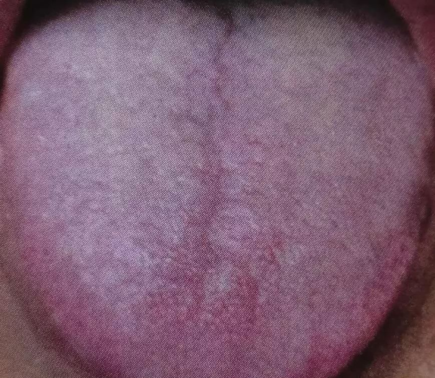 补锌又补硒的药有哪些（补充锌硒的药）-硒宝网