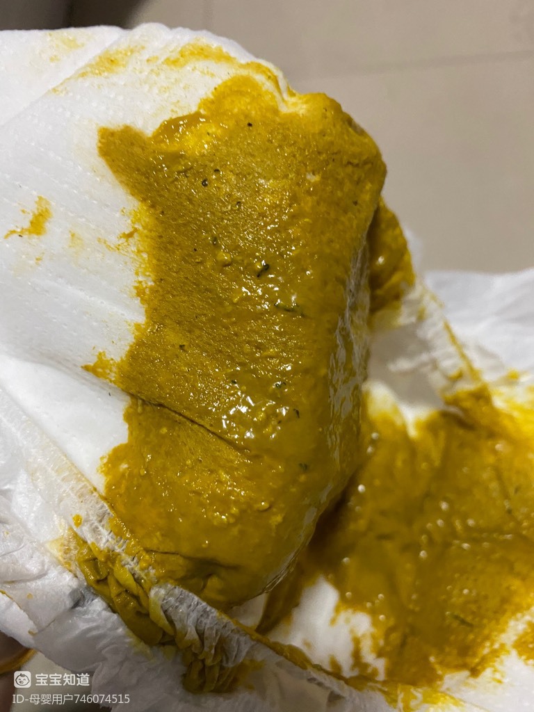 吃啥补铁(吃补铁的药大便是黑色的正常吗)-硒宝网