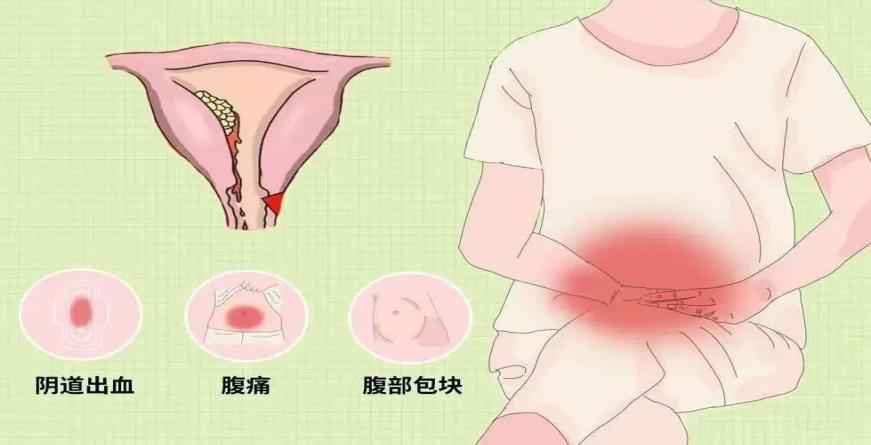 补硒防治子宫内膜癌吗(子宫防治癌补内膜硒可以吗)-硒宝网