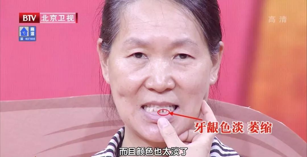 菠菜补铁吗（菠菜补铁效果怎么样）-硒宝网