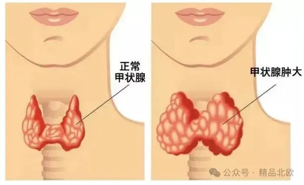 补硒最好的成分是啥呢（补充硒产品）-硒宝网