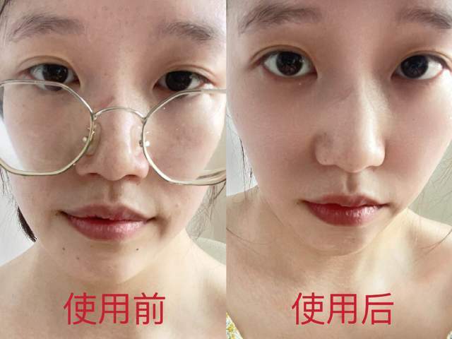 面部补硒美容仪有用吗(补硒对皮肤好吗)-硒宝网