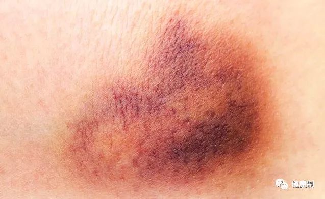 肝不好乏力补硒有用吗（肝病患者补硒）-硒宝网