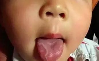 补锌吃什么药（喝补锌的药的不良反应）-硒宝网