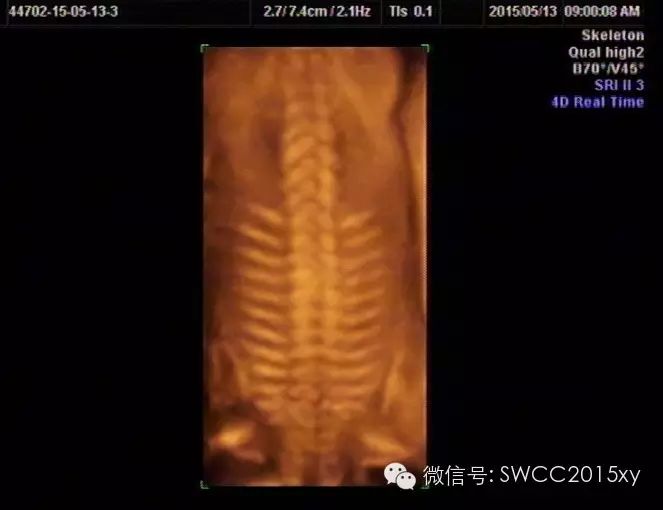 孕晚期多少周停止补钙(孕后期要停止补钙吗)-硒宝网