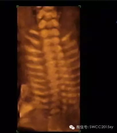 孕晚期多少周停止补钙(孕后期要停止补钙吗)-硒宝网