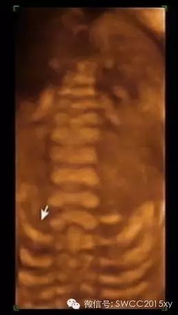 孕晚期多少周停止补钙(孕后期要停止补钙吗)-硒宝网