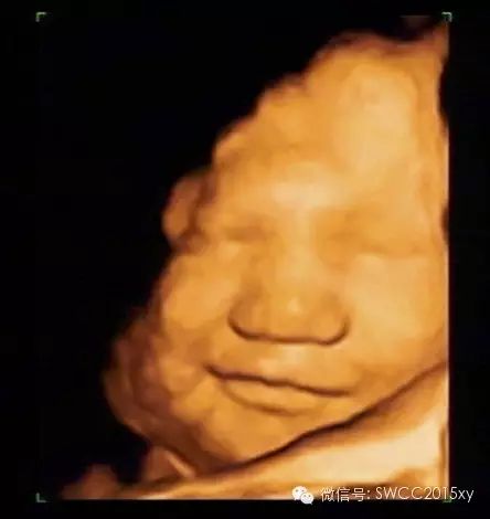 孕晚期多少周停止补钙(孕后期要停止补钙吗)-硒宝网