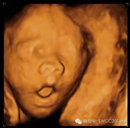 孕晚期多少周停止补钙(孕后期要停止补钙吗)-硒宝网